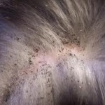 flea "dirt" droppings on dog dog fleas