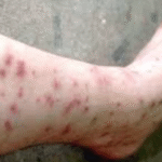 flea repellent humans